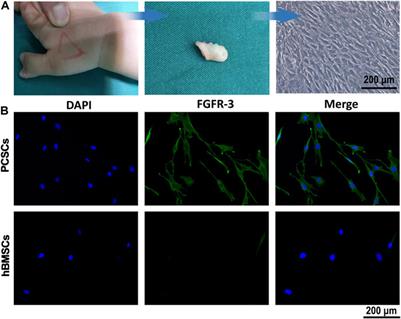 Osteogenesis of Iron Oxide Nanoparticles-Labeled Human Precartilaginous Stem Cells in Interpenetrating Network Printable Hydrogel